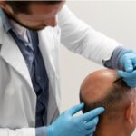 How to Choose Professional FUE Hair Transplant in London Today