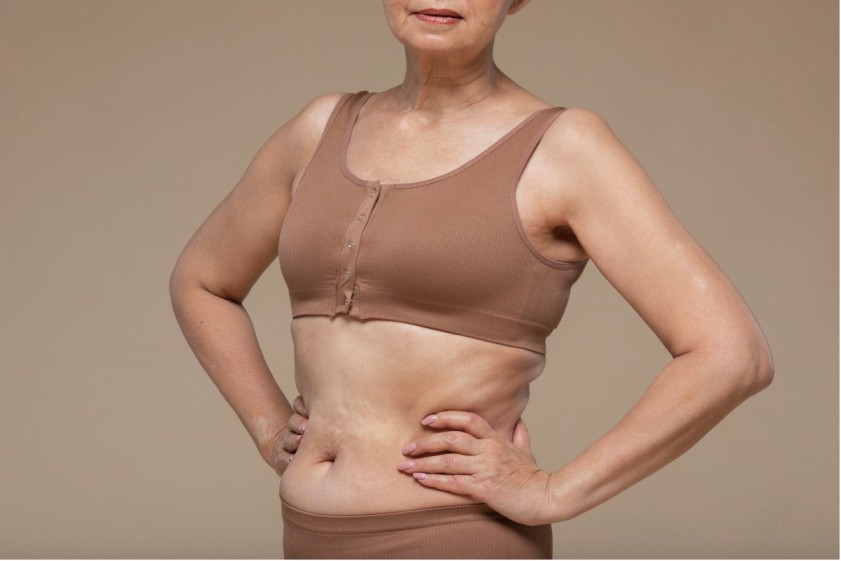 How Fleur De Lis Tummy Tuck Effectively Restores Your Midsection
