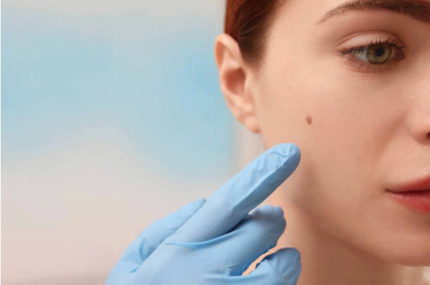 Tips for Treating Thread Veins and Skin Pigmentation